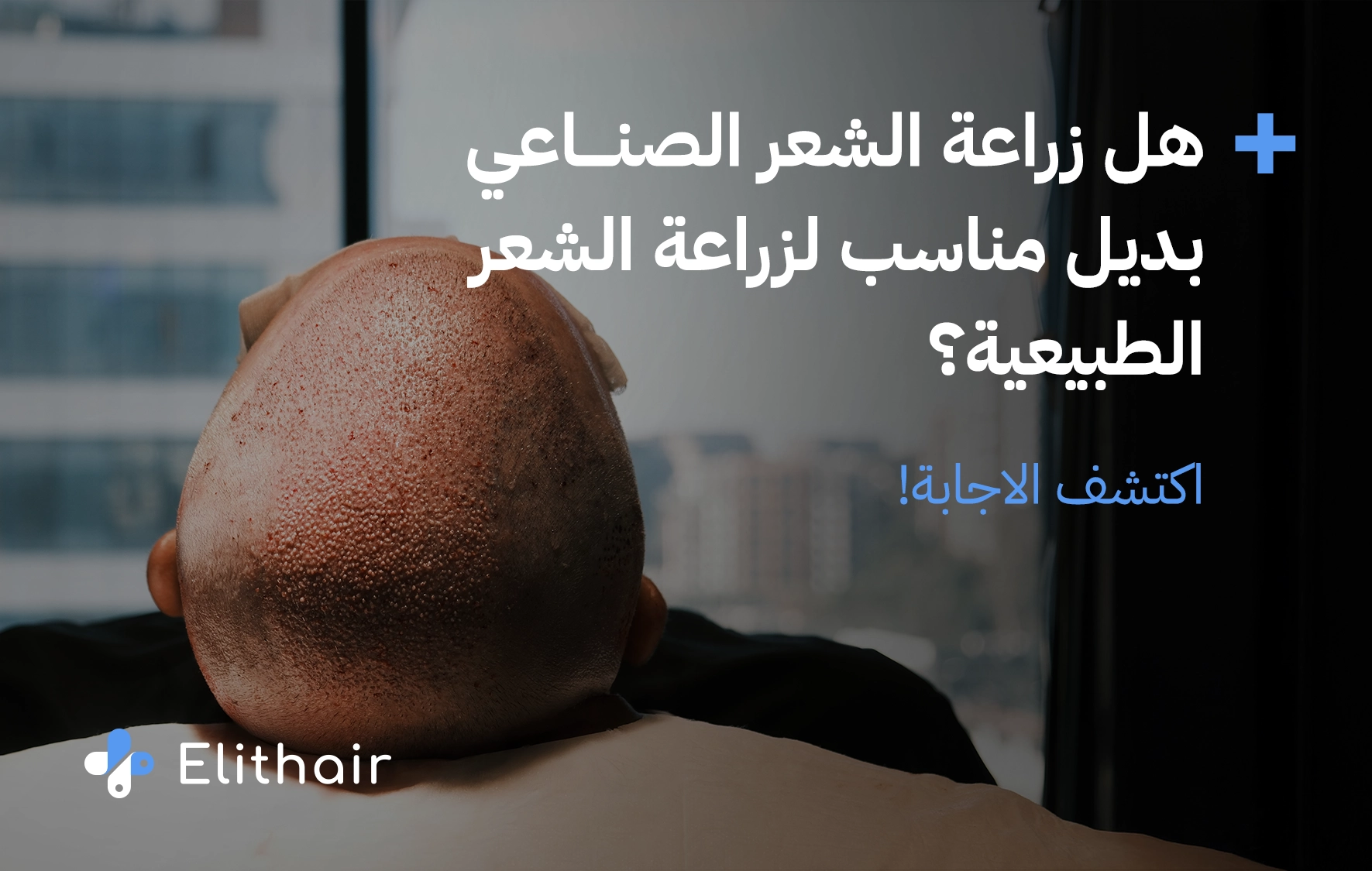 طريقة زراعة الشعر الصناعي في تركيا