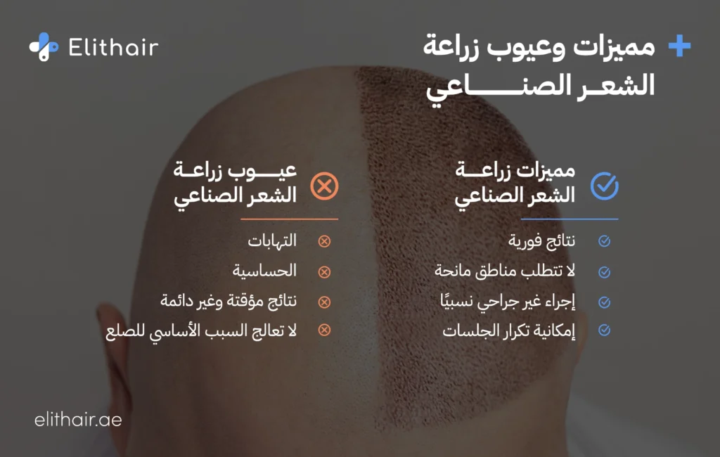مميزات وعيوب زراعة الشعر الصناعي - مركز اليت هير لزراعة الشعر