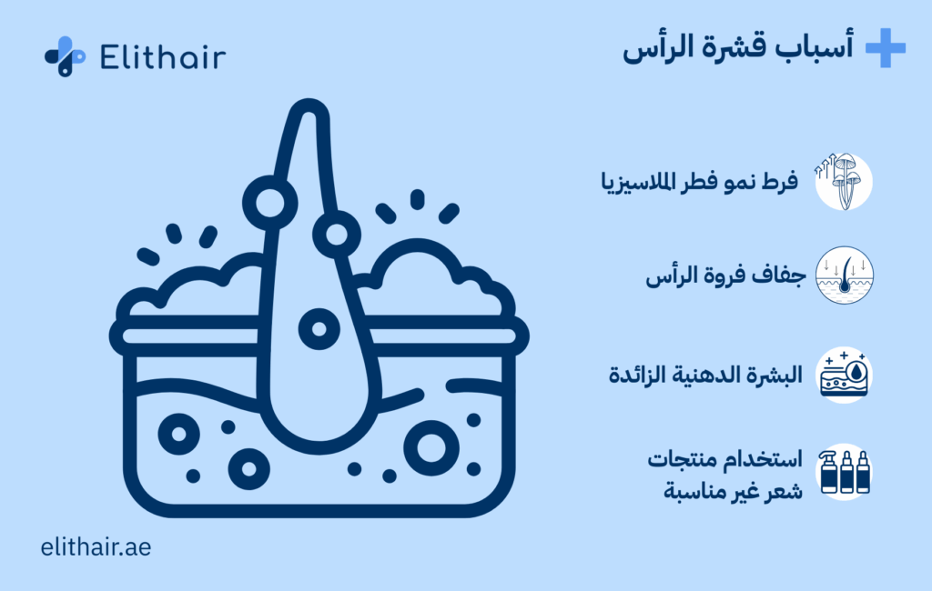 أسباب قشرة الرأس