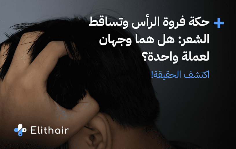 اكتشف علاج الحكة وتساقط الشعر - مشفى اليت هير