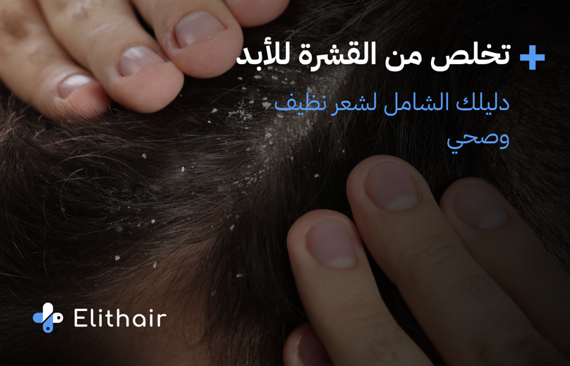 اسباب قشرة الرأس وطرق العلاج الفعالة