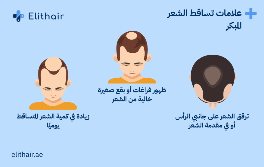 علامات تساقط الشعر المبكر عند الرجال - مركز اليت هير