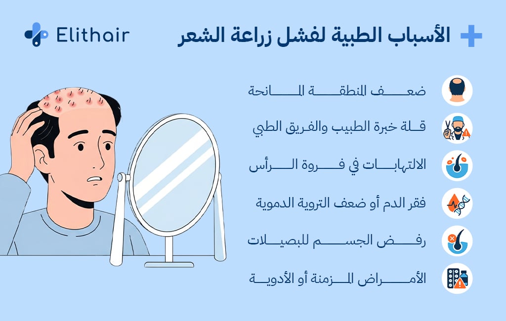 أسباب فشل زراعة الشعر - مركز اليت هير لزراعة الشعر