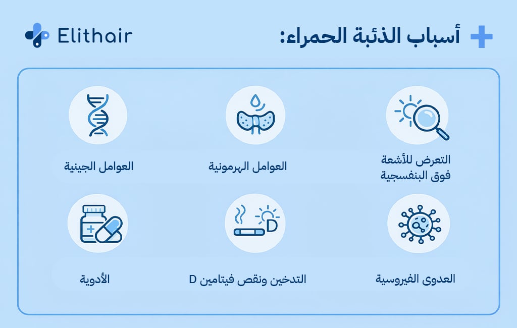 أسباب الذئبة الحمراء - مركز اليت هير لزراعة الشعر