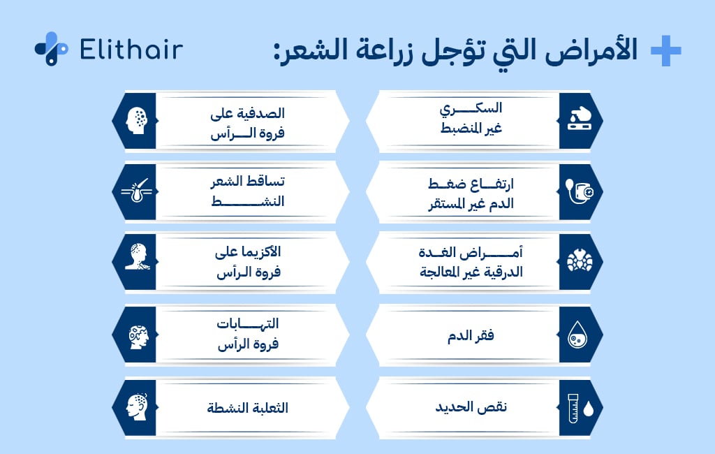 الأمراض التي تؤجل زراعة الشعر - مركز اليت هير لزراعة الشعر