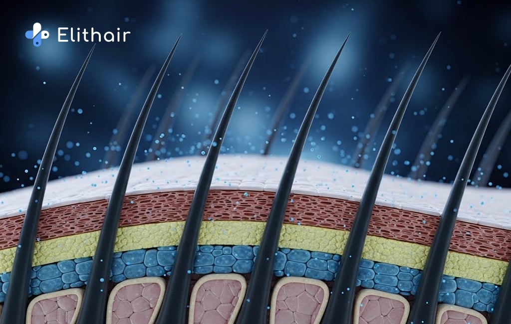 زراعة الشعر بالاستنساخ بين التوقع والحقيقة
