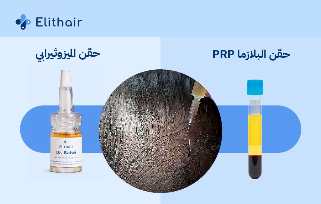 الفرق بين حقن البلازما والميزوثيرابي - مركز اليت هير لزراعة الشعر