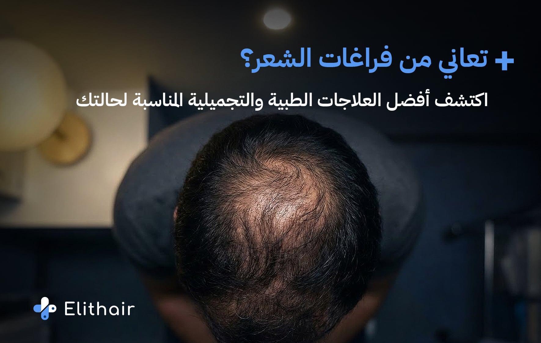 طرق تغطية فراغات الشعر - مركز اليت هير