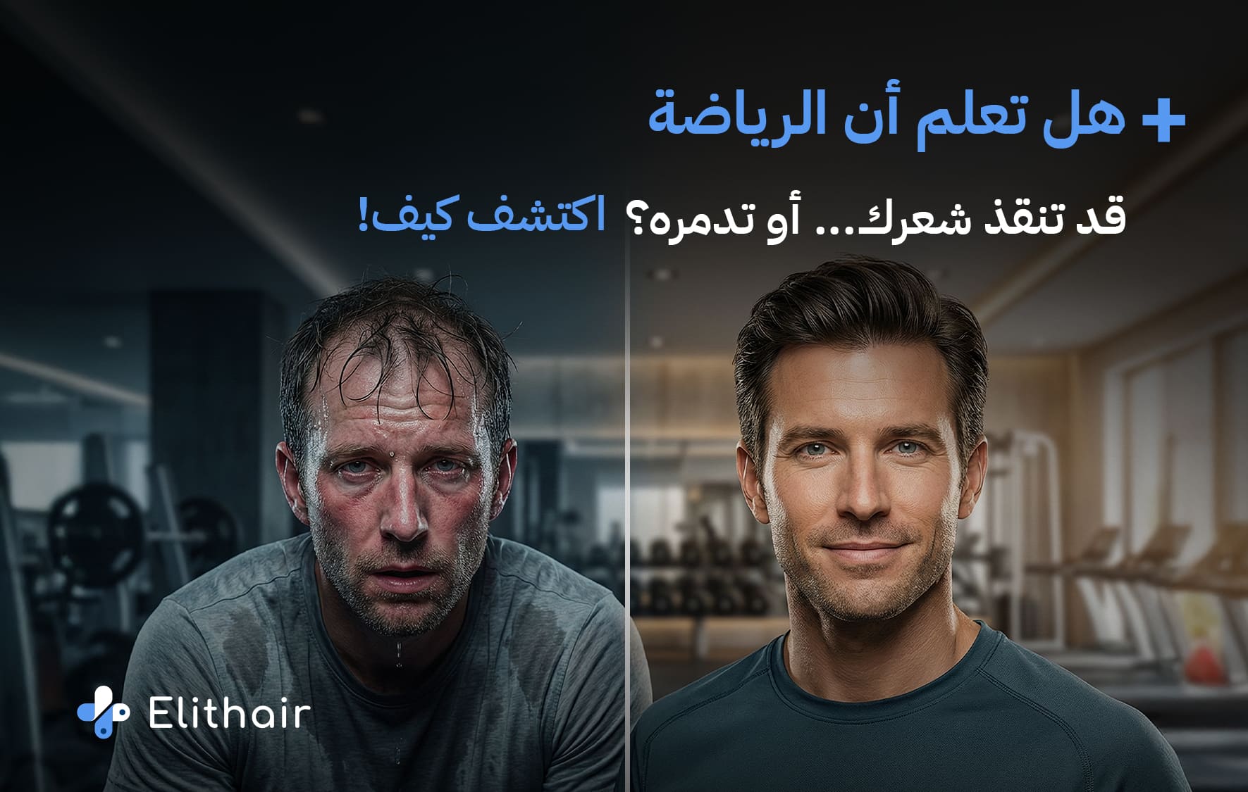 تأثير الرياضة على الشعر - مركز اليت هير لزراعة الشعر