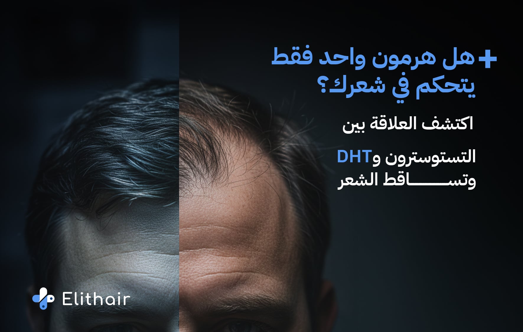 تاثير هرمون التستوسترون على الشعر