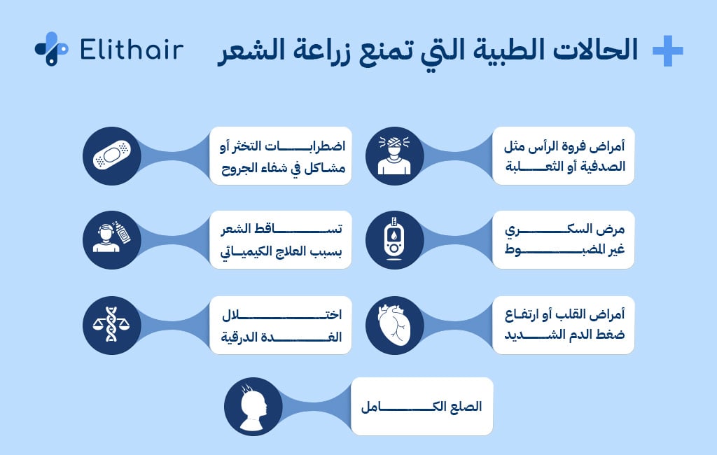 الحالات الطبية التي تمنع زراعة الشعر - مركز اليت هير لزراعة الشعر
