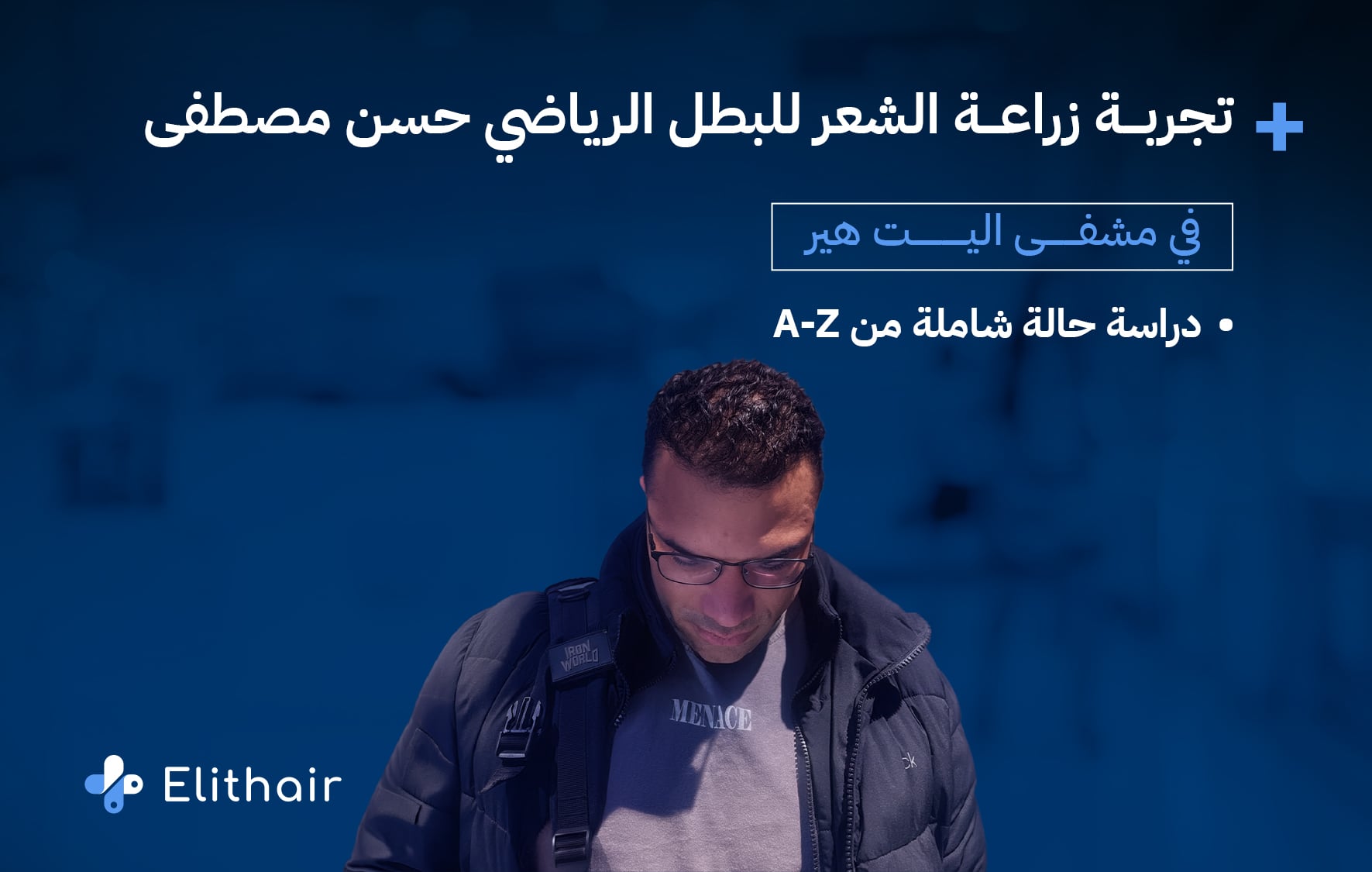 تجربة زراعة الشعر لحسن مصطفى في اليت هير